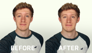 Lens Distortions